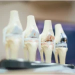Orthopaedic instruments catalog manufactured by Hypex Surgical Instruments