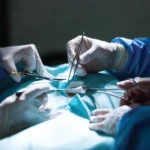 Urology instruments catalog manufactured by Hypex Surgical Instruments